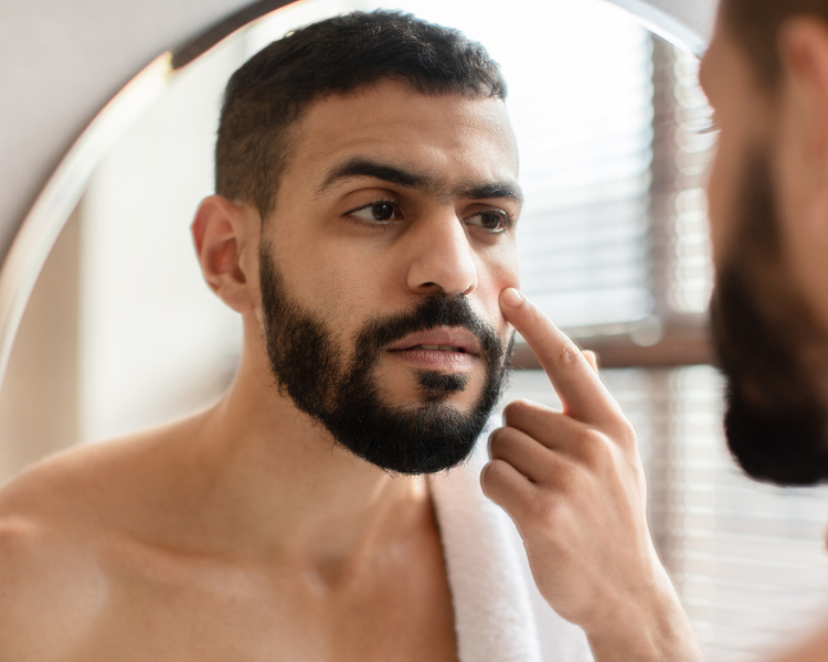 Puffy Eyes Treatment