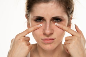 how to apply eye cream for dark circles
