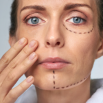skin tightening