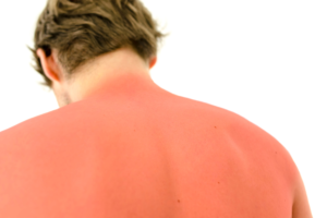 early skin cancer symptoms 