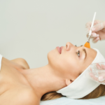 salicylic acid vs glycolic acid