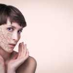 damaged skin barrier
