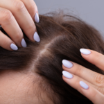 hair loss and thyroid