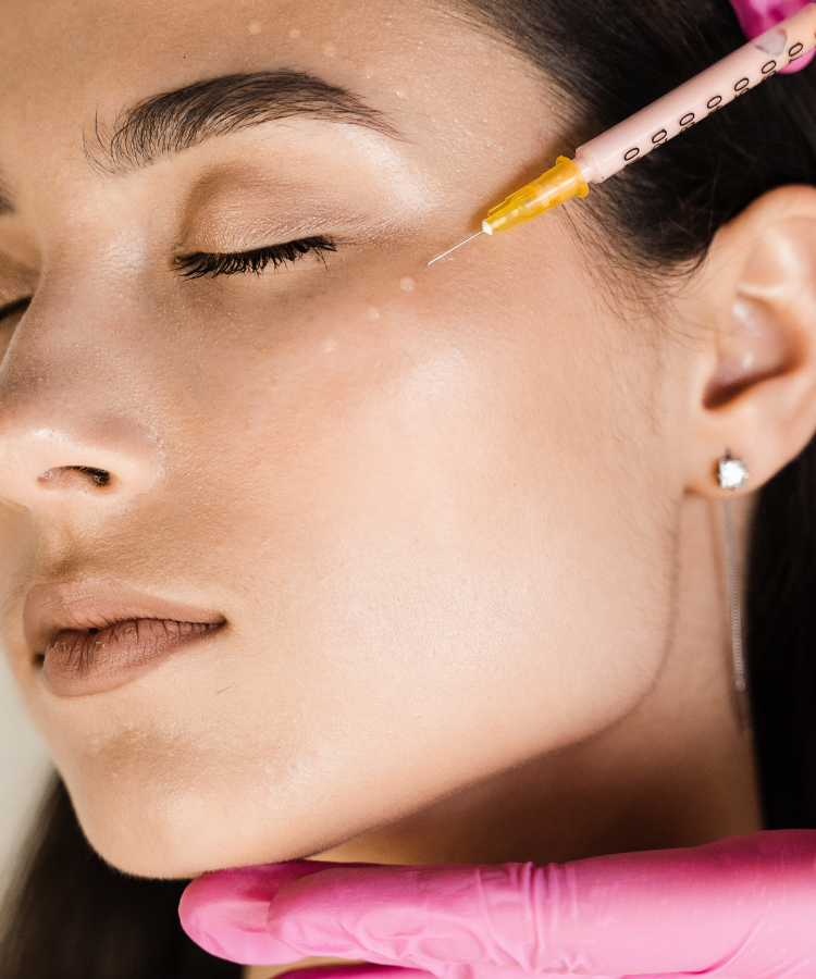 melasma tranexamic acid