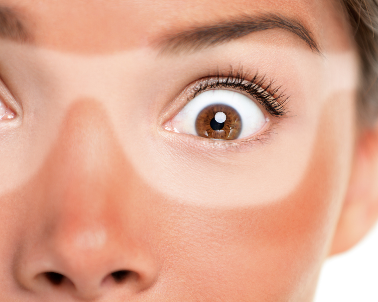 is tea tree oil good for sunburn