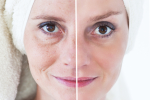 benefits of facials