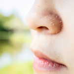 best face wash for seborrheic dermatitis