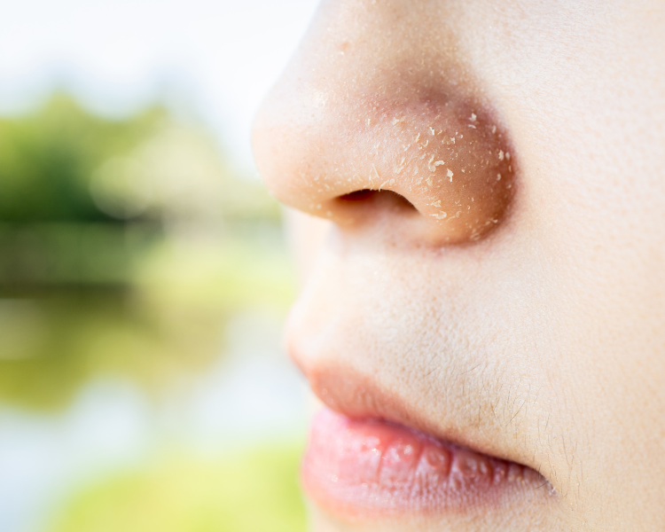 best face wash for seborrheic dermatitis