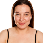 menopause and allergies increasing