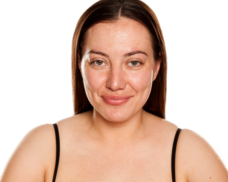 menopause and allergies increasing