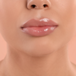 botox lip flip vs filler