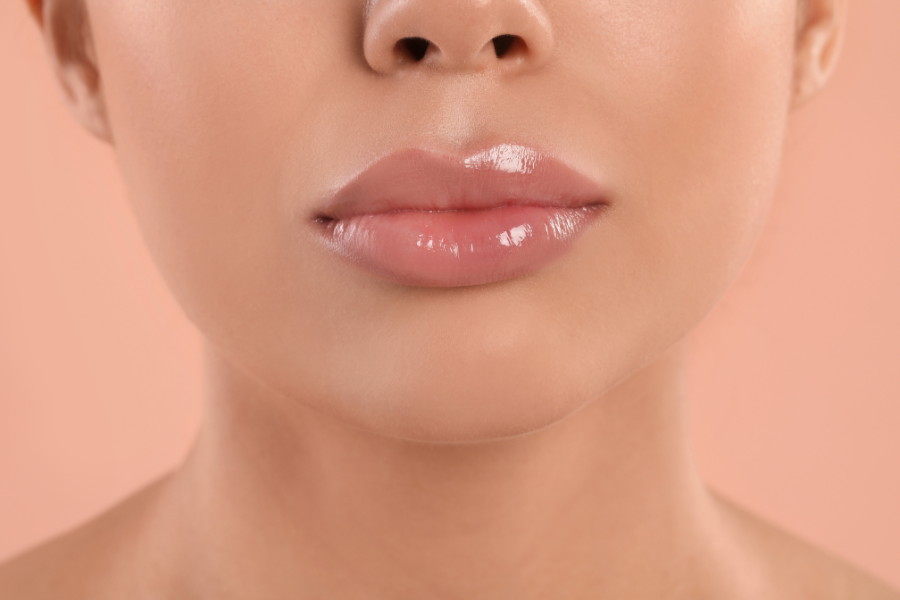 botox lip flip vs filler