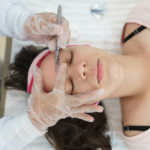dermaplaning vs chemical peel