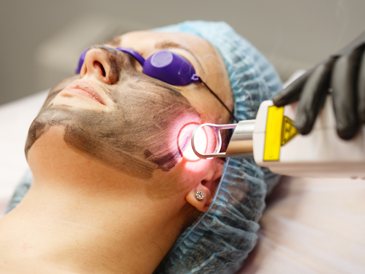 Best tranexamic acid for melasma