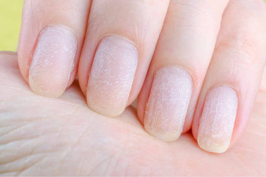 how to heal damaged nails after acrylics