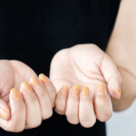 yellow nails after nail polish