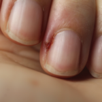 nail ridges vertical warning signs