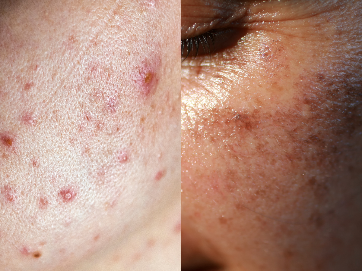best pretty skin care products best products for glowing skin