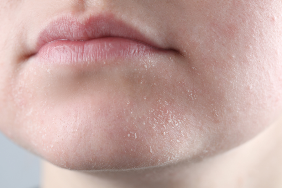 dry skin care routine products